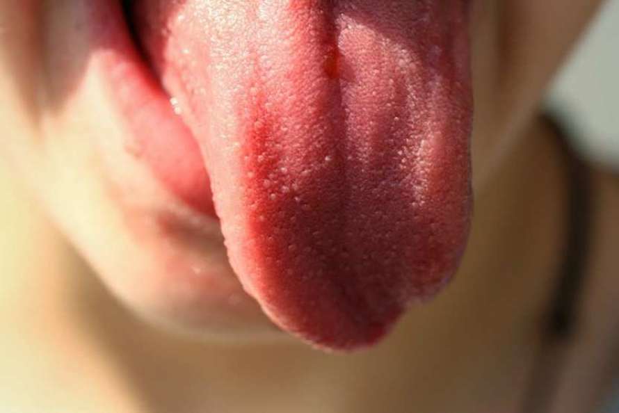 Характеристика кровяного пузыря на слизистой рта