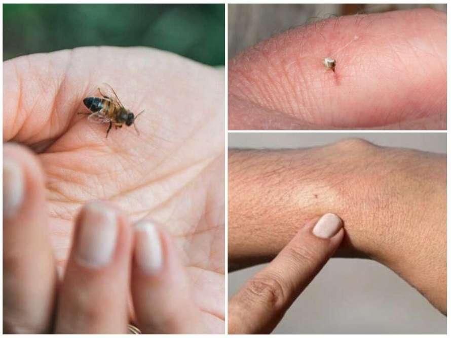 Токсиколог объяснил, чем может быть опасен укус осы